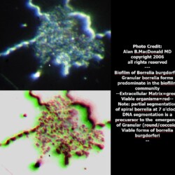 annotated_comparison_of_granular_borrelia_biofilm_community-1244x1130