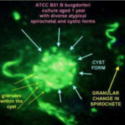 spirl-cystic-and-granular-borrelia